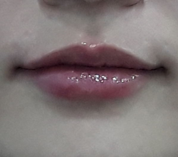 Before