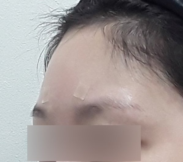Before