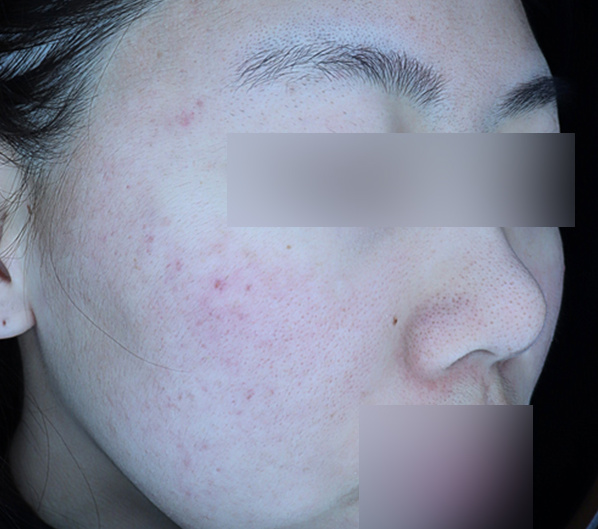 Before