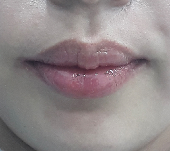 Before