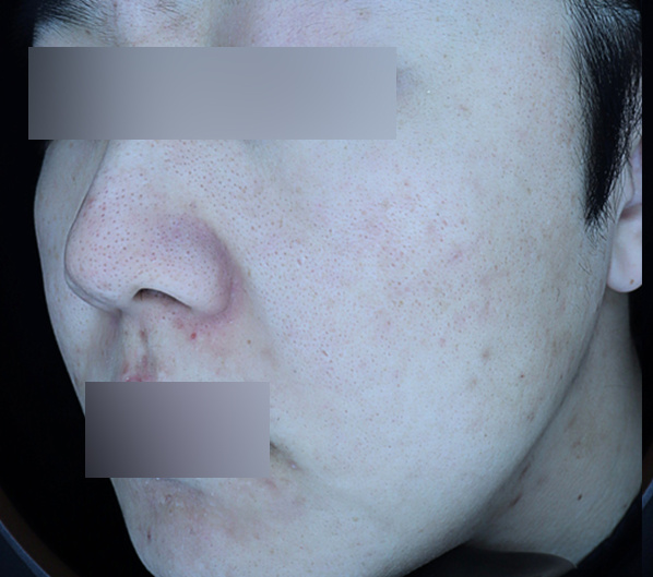 Before