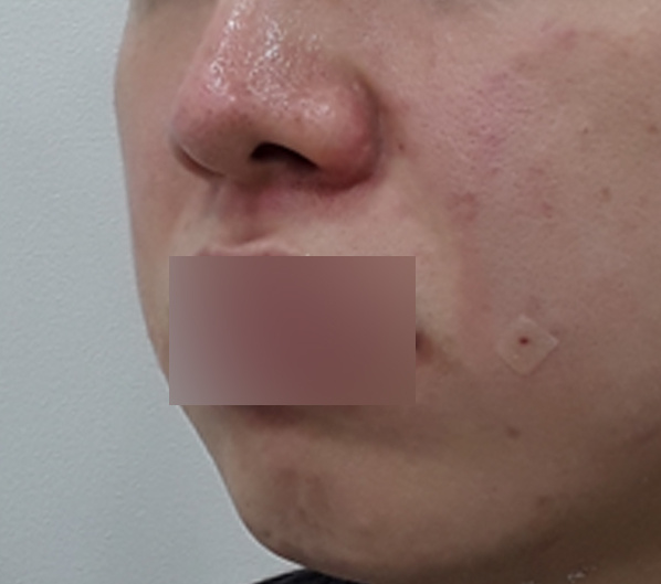 Before