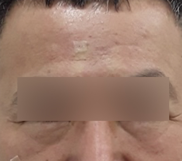 Before