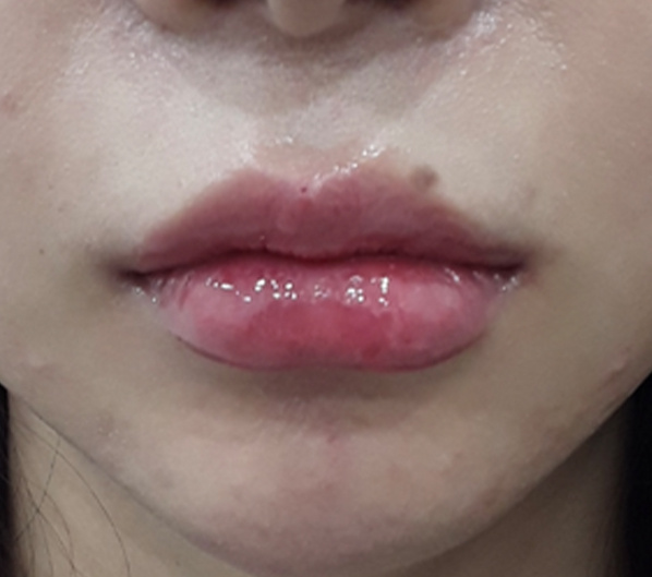 Before