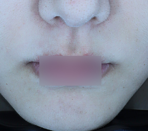 Before