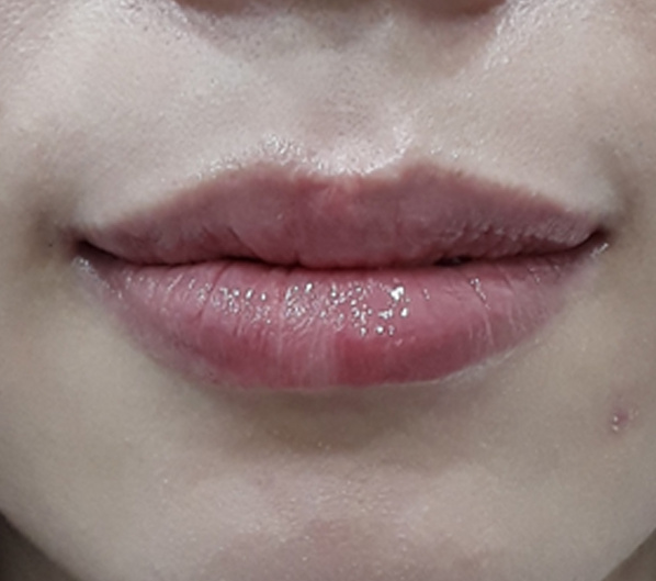 Before