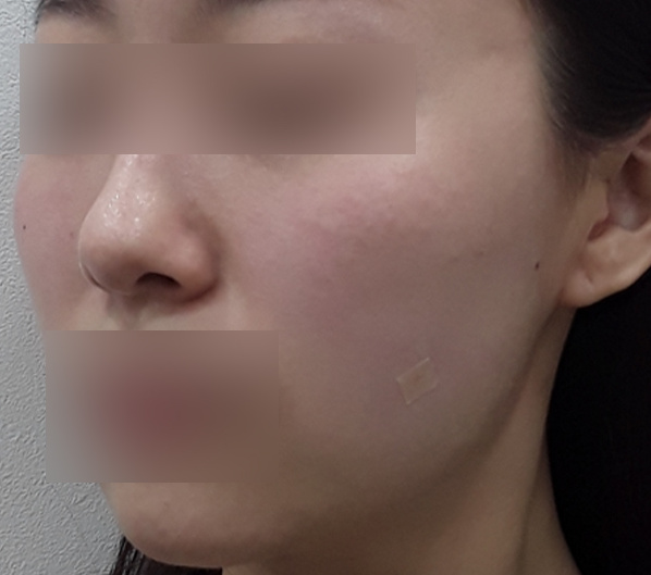 Before