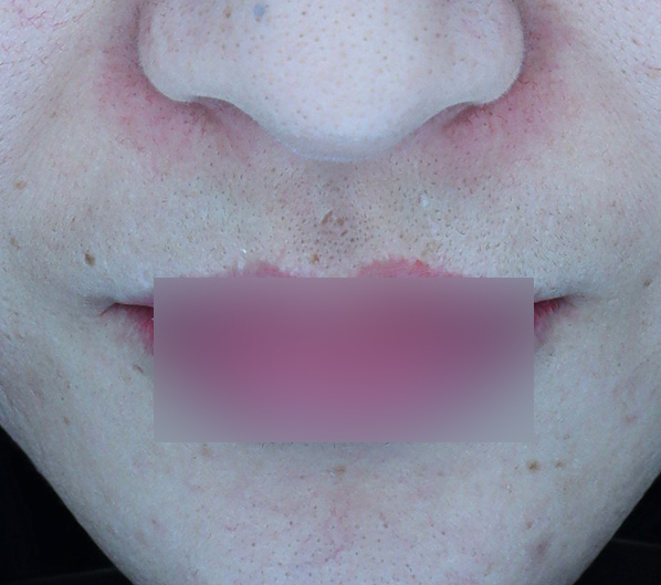 Before