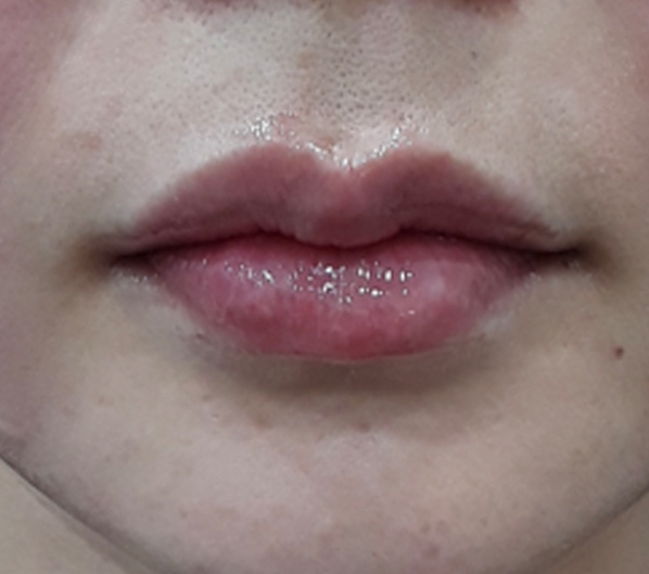 Before