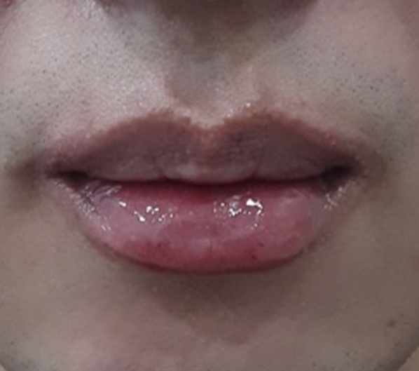 Before