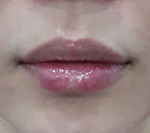 Before