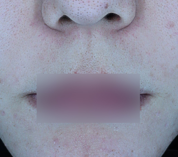 Before