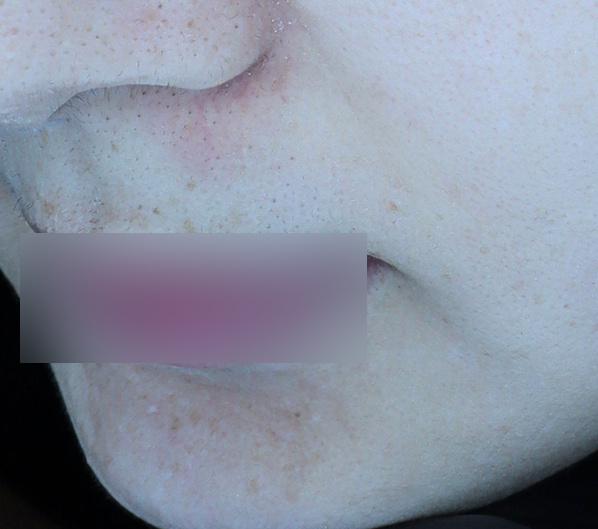 Before