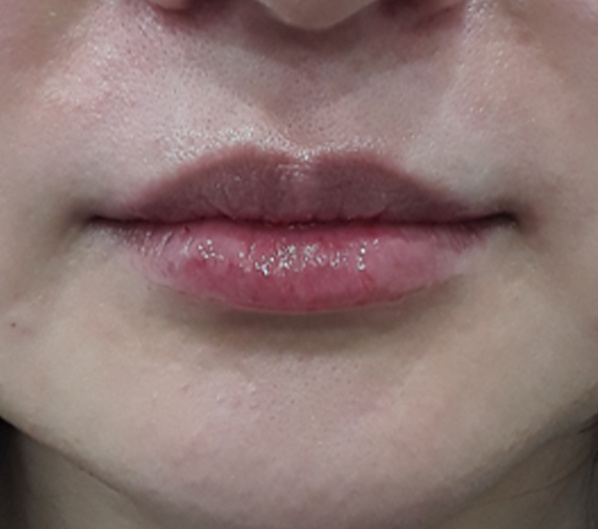 Before