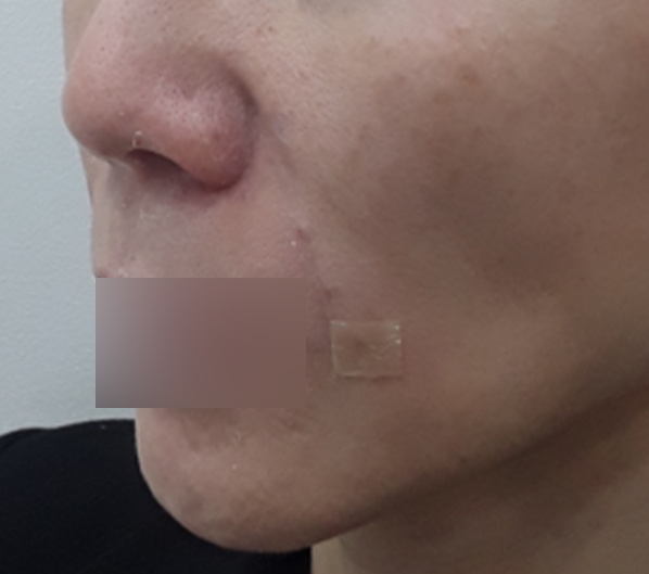 Before