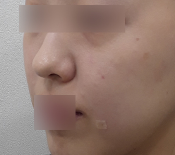 Before