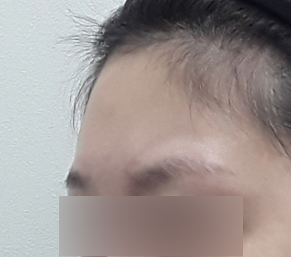 Before