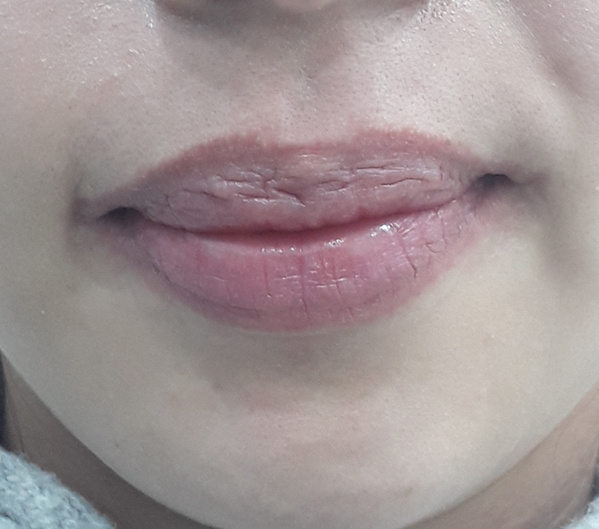 Before