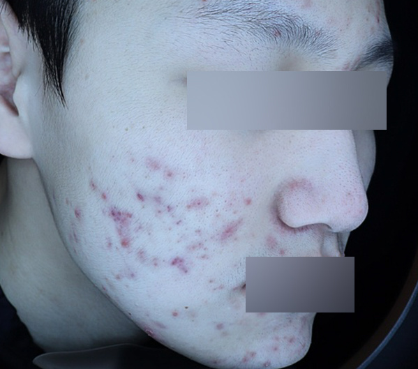 Before