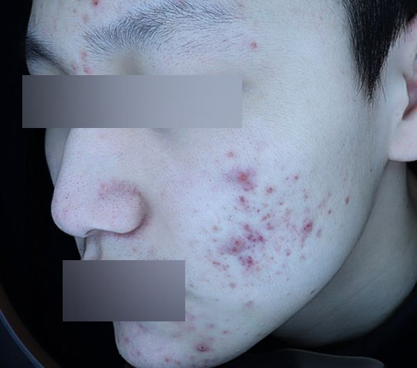 Before