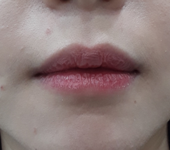 Before