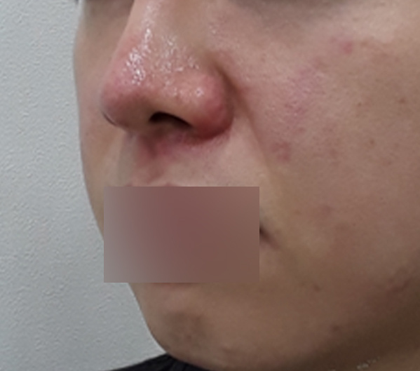 Before