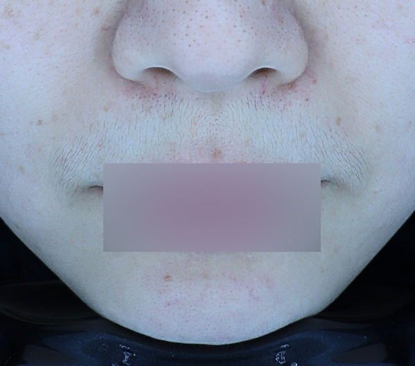 Before