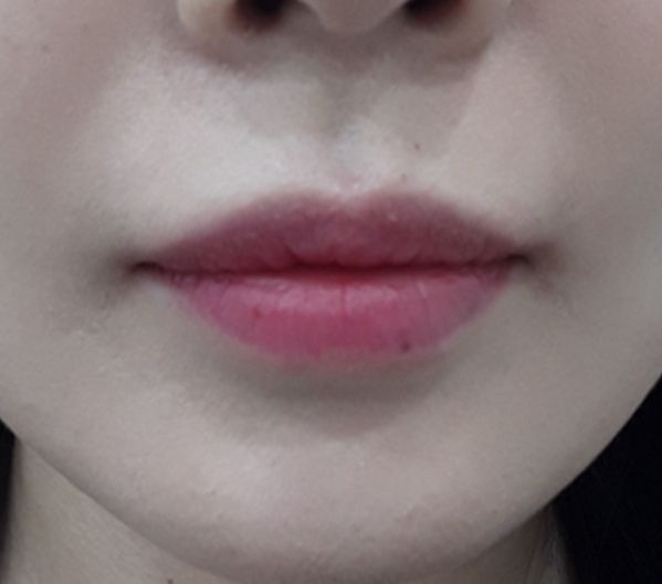Before