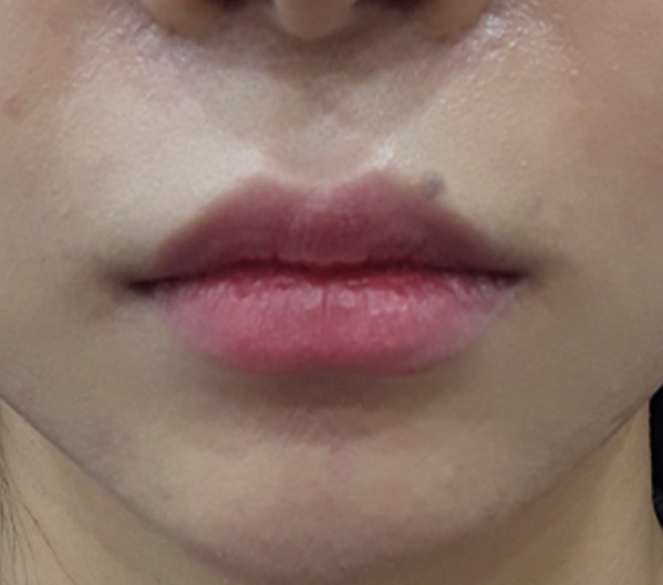 Before