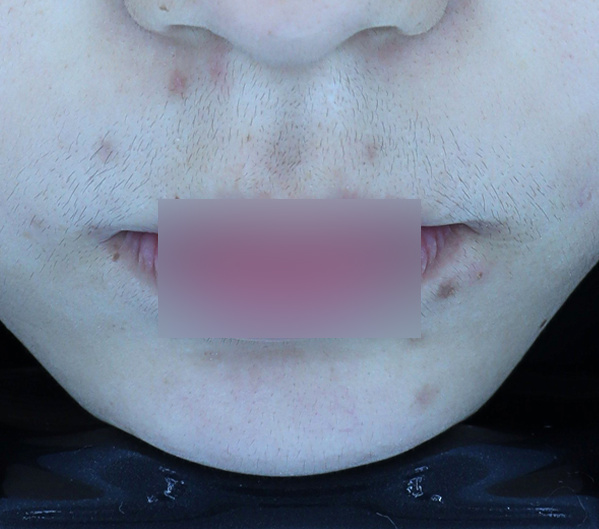 Before