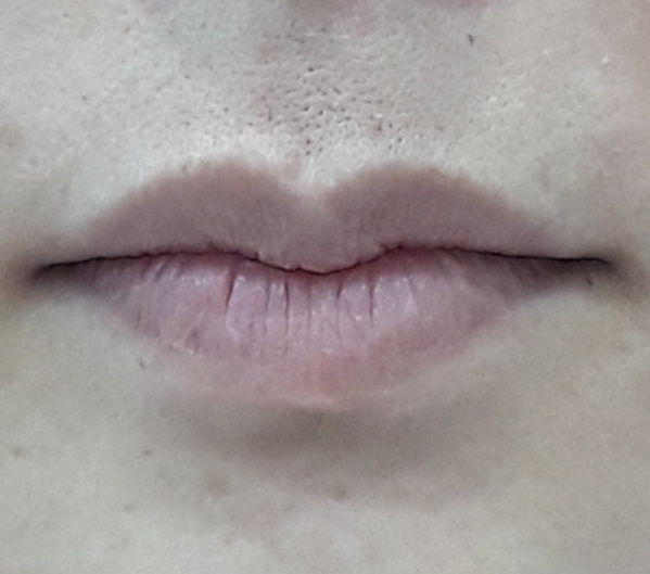 Before