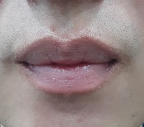 Before