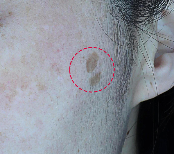 Before