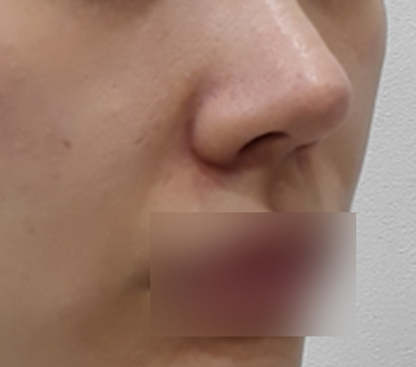 Before