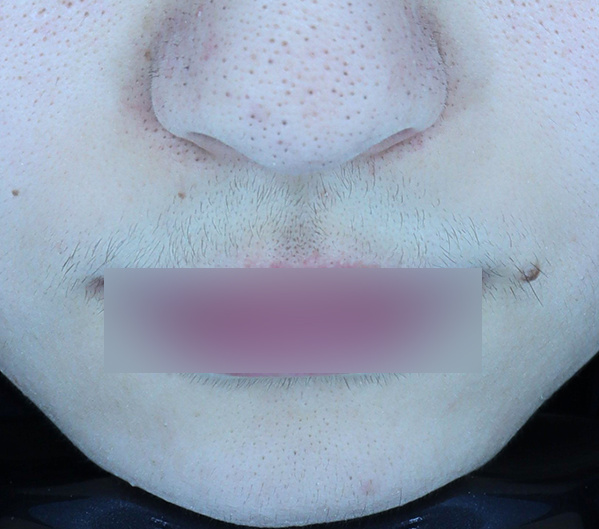 Before