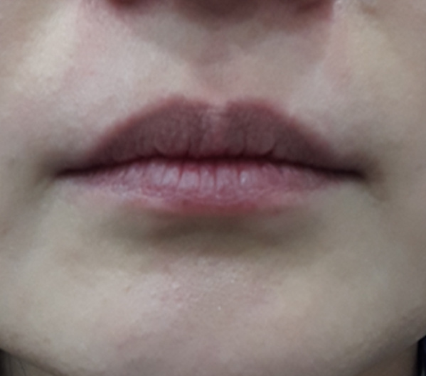 Before