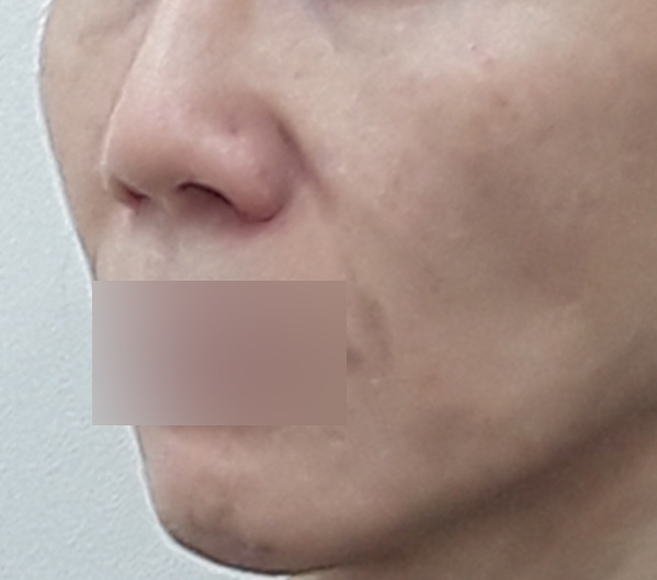 Before