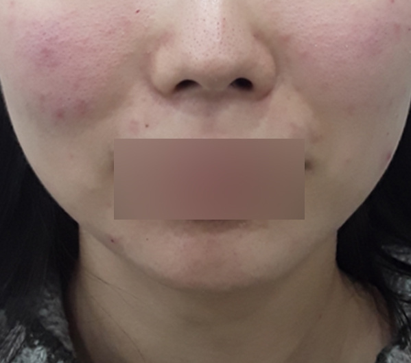 Before