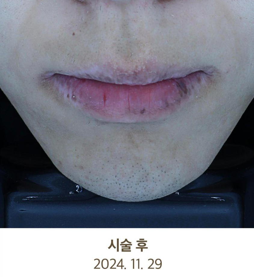Before