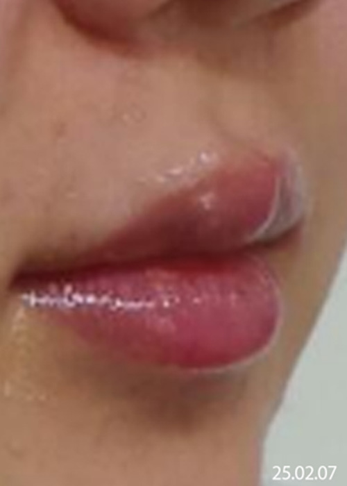 Before