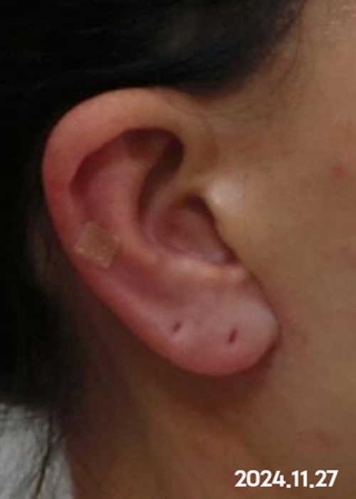 After