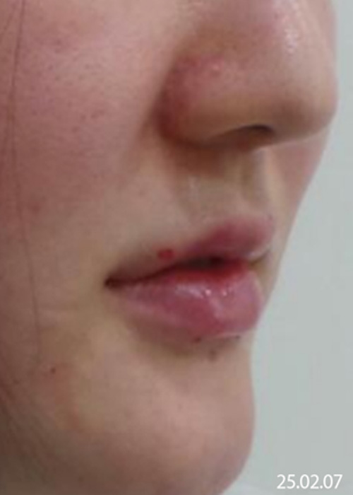 After