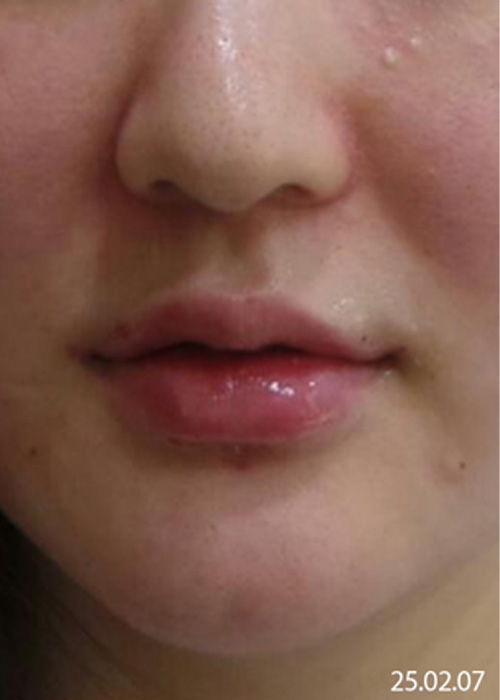 After