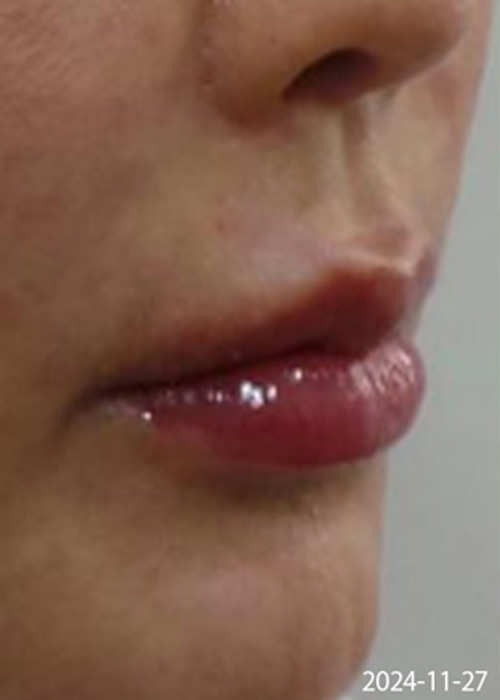 After