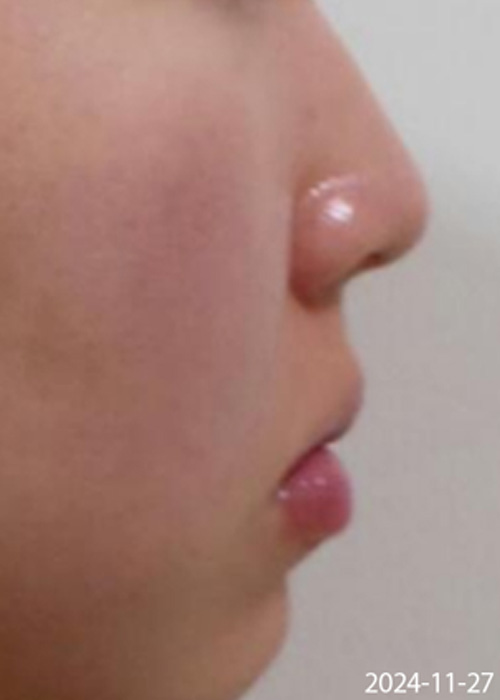 Before