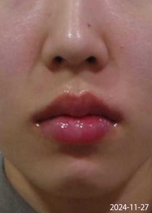 After