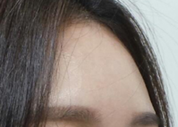 After