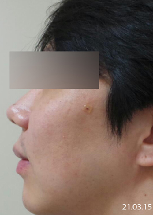 After
