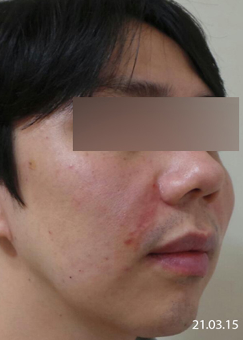 Before