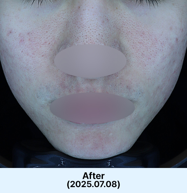 Before